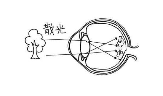 散光到底是什么？能治好吗？